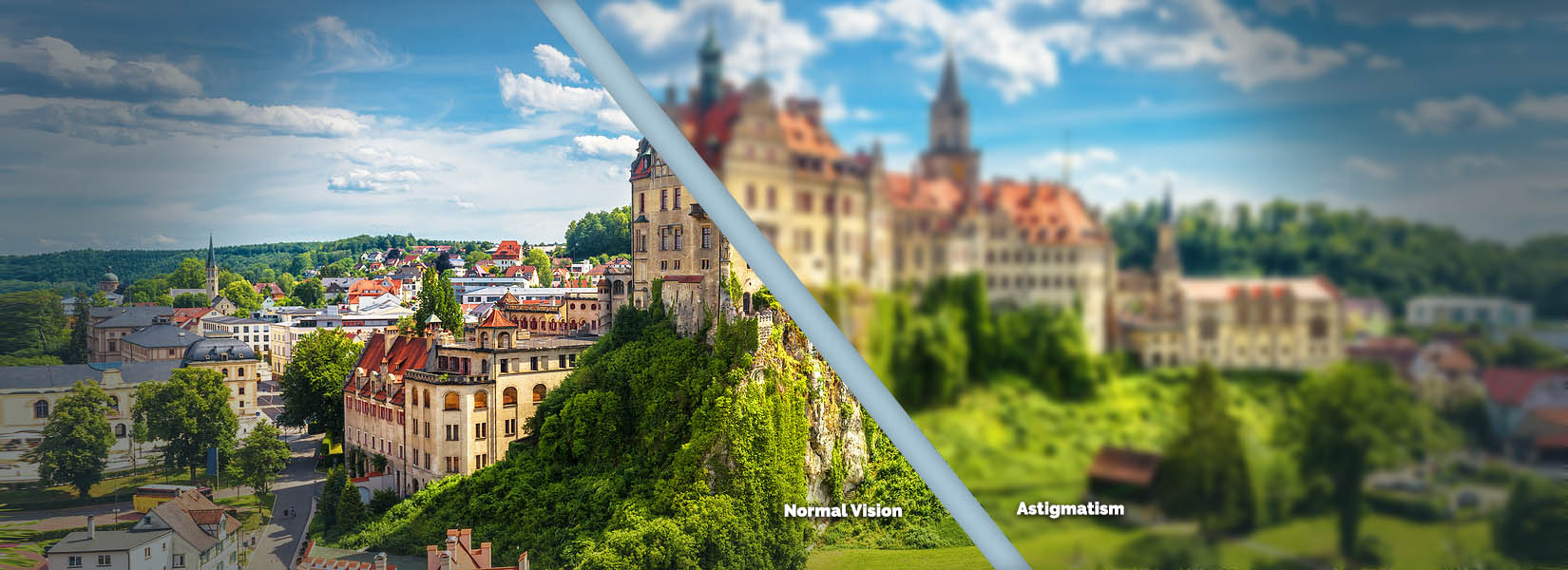 Astigmatism Treatment in Manchester