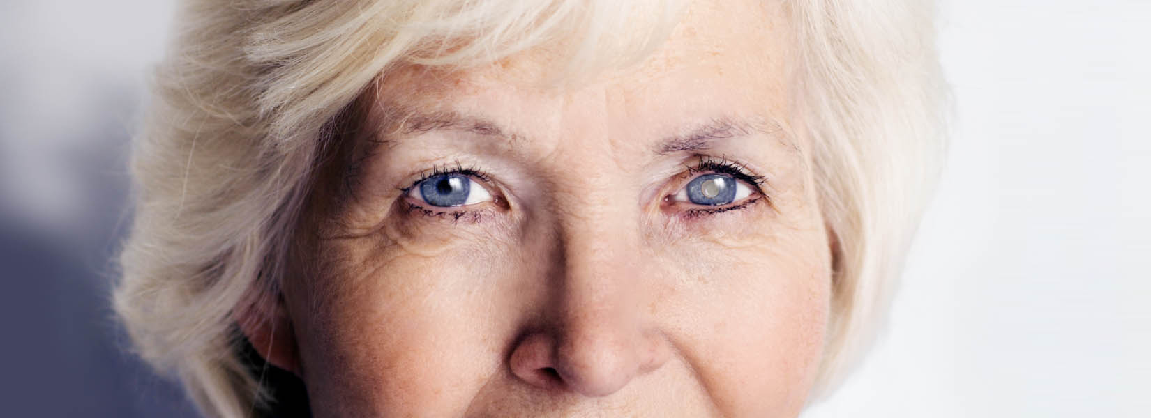 Cataract Surgery in Manchester
