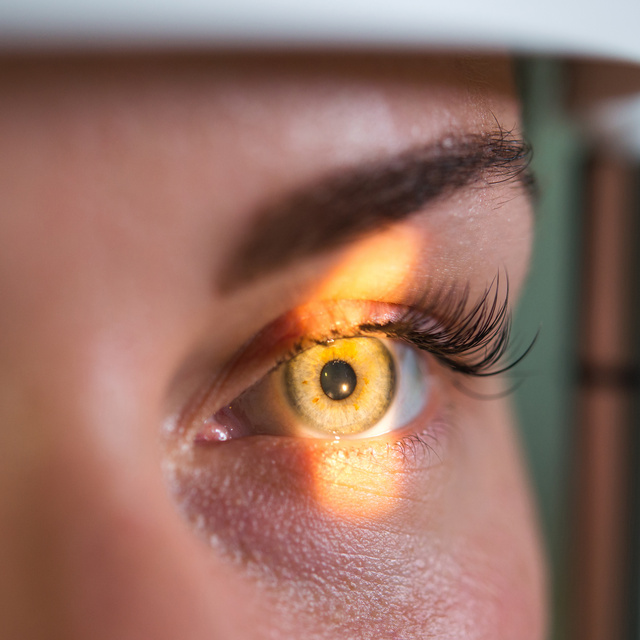 Vision Therapy in Manchester